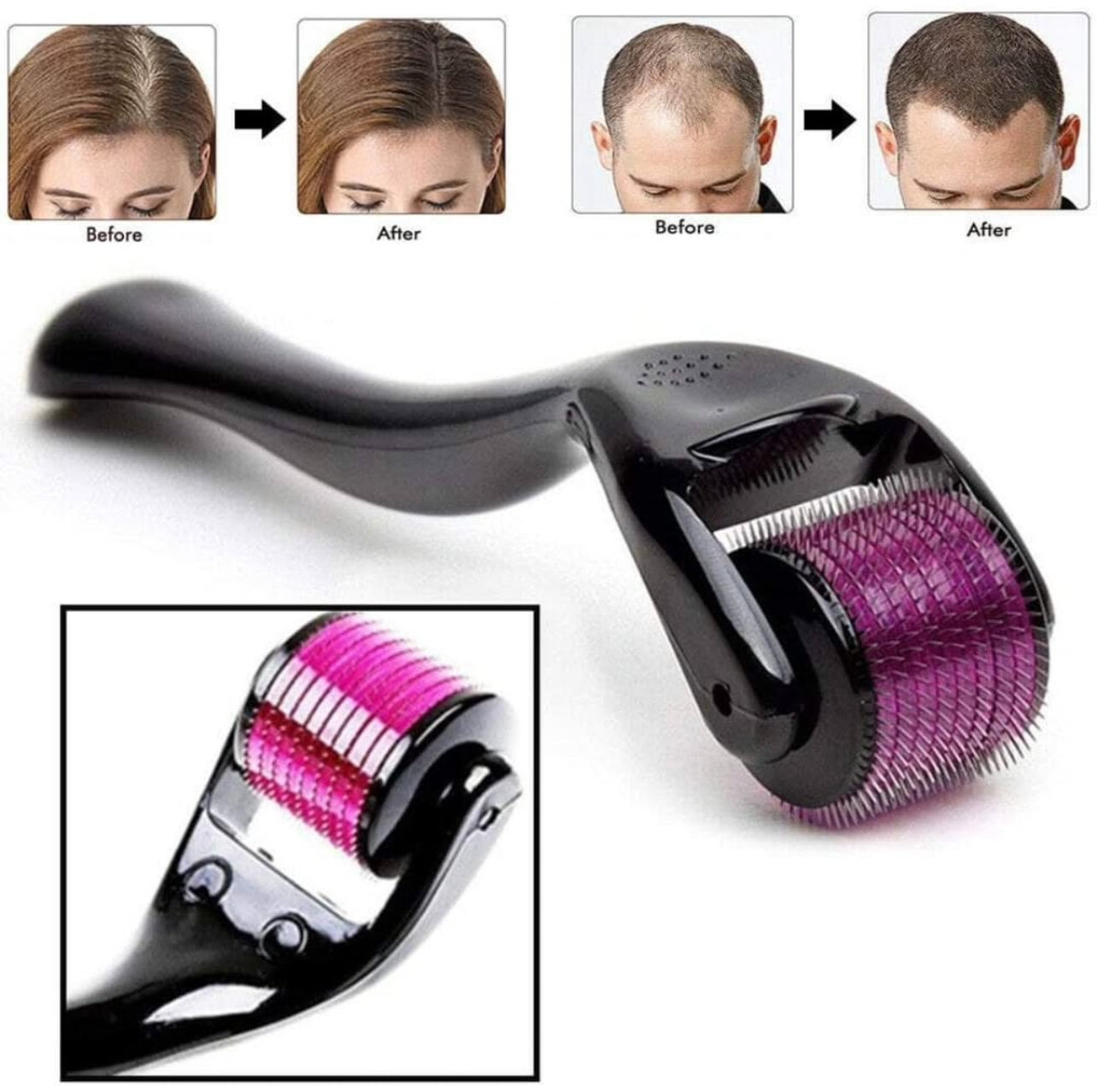 Derma-Roller